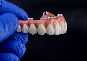 a person holding an implant prosthetic