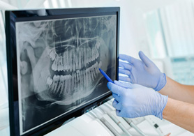 a dentist pointing at an X-ray